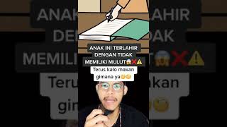 Terlahir tidak memiliki mulut 😭