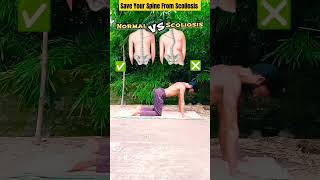 Escape the pain: How to save your snipe from scoliosis||Spine Exercise||