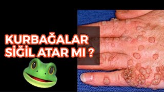 KURBAĞAYA DOKUNURSAK NE OLUR ? Siğil atar mı ?