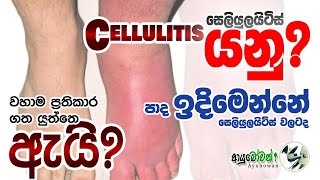 Cellulitis | සෙලියුලයිටිස් |Anushika Perera|  AYUBOWANආයුබෝවන්