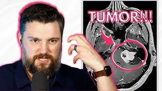 Ep. 59 Do YOU have ACOUSTIC Neuroma??? Signs and symptoms of this TUMOR