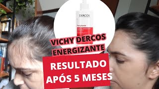 resultado do dercos Vichy após 5 meses