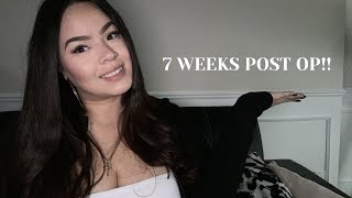 7 WEEKS POST OP | RNY | GASTRIC BYPASS | FITTING INTO THINGS AGAIN