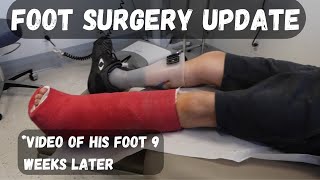 15 yr old's surgery UPDATE | Charcot Marie Tooth Disease