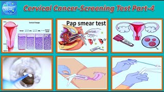 Cervical Cancer Symptoms, Causes, Types, Risk factor, Diagnosis,Treatment test Part 4