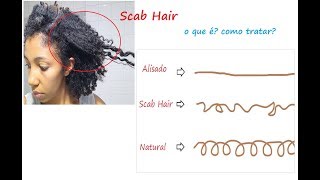 Scab Hair - o que é, como tratar e minha experiência!