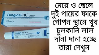 Fungidal Hc Carem দুই পায়ের গোপন স্থানে খুব চুলকানি দানা দানা হচ্ছে তাদের জন্য ভাল একটা ক্রিম ৷