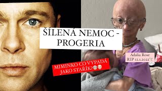 ŠÍLENÁ NEMOC KDE SE ČLOVĚK DOŽIJE MAX 15 LET? - PROGERIA