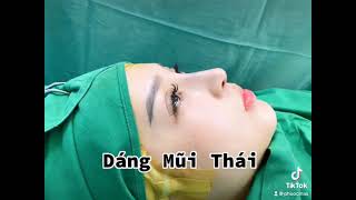 #nangmui #phongkhamthammy #dangthai NÂNG MŨI DÁNG THÁI