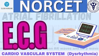 ABNORMAL HEART RHYTHM ECG | CARDIO VASCULAR SYSTEM DYSRHYTHMIA |  MEDICAL SURGICAL NURSING | #norcet