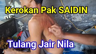 Ciri khas Kerokan Pak SAIDIN: Motif Tulang Jair Nila || Pakar Pijat Urut / Refleksi