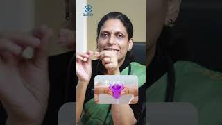 Menstrual Cup ഉപയോഗിക്കുമ്പോൾ ശ്രദ്ധിക്കേണ്ട പ്രധാന കാര്യങ്ങൾ | Menstrual Cup Tips in Malayalam