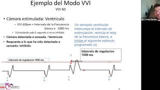 18 - Estimulación Cardíaca (Marcapasos)