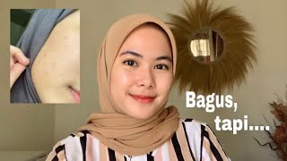 Review Jujur Lacoco Dark Spot Essence Pemakaian 1 Bulan