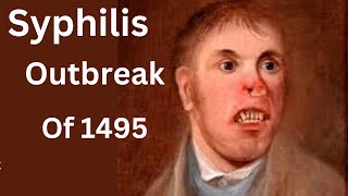 Europe's 1495 Syphilis Outbreak: The Untold Story