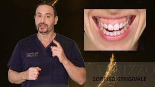 Cos'è il trattamento del sorriso gengivale - Studio Dentistico Cannizzo Milano