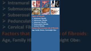 Fibroid Types, Alternative names, Diagnosis, Tests, Part 2 #biology #fibro #shorts #viral