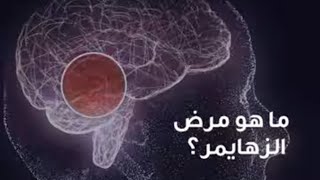 Whar is Alzheimer's disease? | Dr. Amir Abdelghaffar | Reem Hospital Abu Dhabi