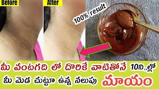 How to Get rid of Dark Neck Fast in Telugu/How to remove dark neck fast in Telugu