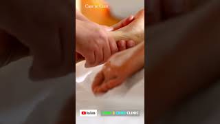 சுஜோக் சிகிச்சை முறை / Care To Cure