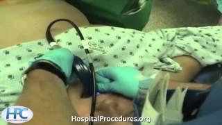 Glidescope Intubation Video