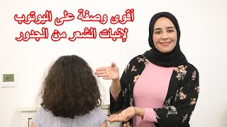 معاناتي مع الصلع 🥺 وكيف أنبث شعري من جديد😍 النتيجة واو💃