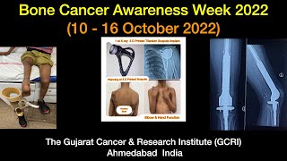 Bone Cancer Awareness