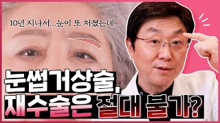 눈썹거상술은 재수술 절대 못한다?! 유지기간이 짧다? 팩트체크 YES or NO - 의학박사 백승준