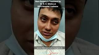 Plastic Surgeon saved my wife's life | Best Plastic Surgeon | Burn Surgery #review #feedback #burn