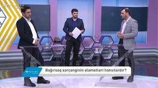 Bağırsaq xərçənginin əlamətləri hansılardır? - LIVe Doctor