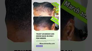 #blackownedbusiness #naturalhair #haircareproducts EDGES CAN GROW BACK FASTER