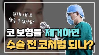 코 보형물 제거하면 수술전 코처럼 되나요?