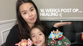 16 WEEKS POST OP | RNY | GASTRIC BYPASS | HEALING FROM HERNIA