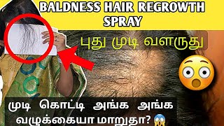 😍முன் நெற்றியில் முடி வளரும்🤩hair regrowth hair spray 🧴