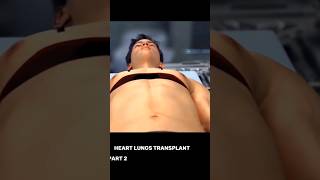 Lungs Transfer #shorts