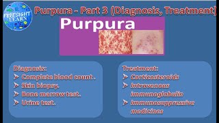 Purpura   Part 3 Diagnosis, Treatment