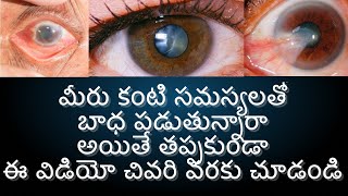 SV Aravind Eye Hospital || Tirupati ||Chittoor Dist|| AndhraPradesh || Sweety World|| Telugu vlogs||