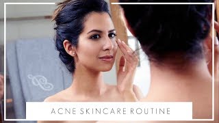 HOW I DEAL WITH ACNE & PIGMENTATION | Evening Skincare Routine | JASMINA PURI