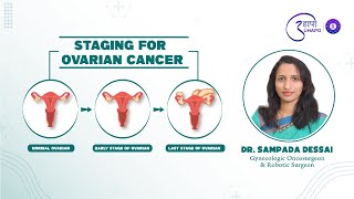 Know about staging in Ovarian Cancer from Dr. Sampada Dessai.