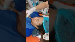 dermapen y mesoexfoliación