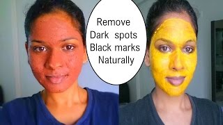 Remove dark spots or black marks [Pimple or acne marks ] | Two best face masks |