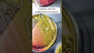 catalase test microbiology results interpretation #dmlt_video #dmlt #labtech #labtechnicians