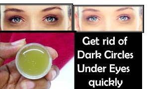 DIY Eye serum to remove Dark circles in 1 week | StarNaturalBeauties