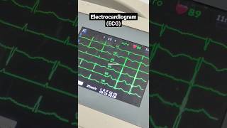 Electrocardiogram that checked by ECG Simulator #ecg #health #technology #elektromedik #engineer