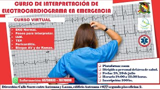 CURSO VIRTUAL DE INTERPRETACION DE ELECTROCARDIOGRAMA EN EMERGENCIA