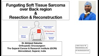 Fungating Soft Tissue Sarcoma over Back region