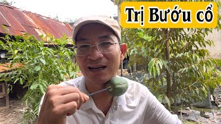 Cách trị Bướu cổ rất hay. PHAN HẢI Vlog