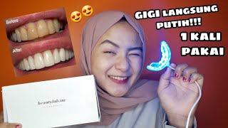 Cara Memutihkan Gigi Dengan Cepat Dan Instan || Sofirosfi