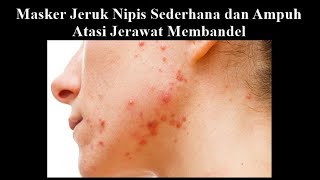 Masker Alami Jeruk Nipis Untuk Mengatasi Jerawat dengan Cepat