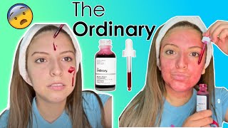 Trate El Peeling Solution de THE ORDINARY y Esto Le Paso A Mi Cara || Me Quemo la Piel? 😮